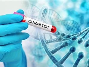 Phát triển ứng dụng xác định các gene chỉ thị sinh học về ung thư 